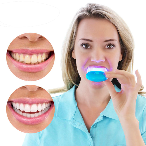Home Teeth Brightening Kit