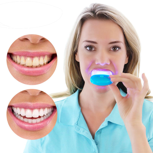 Home Teeth Brightening Kit